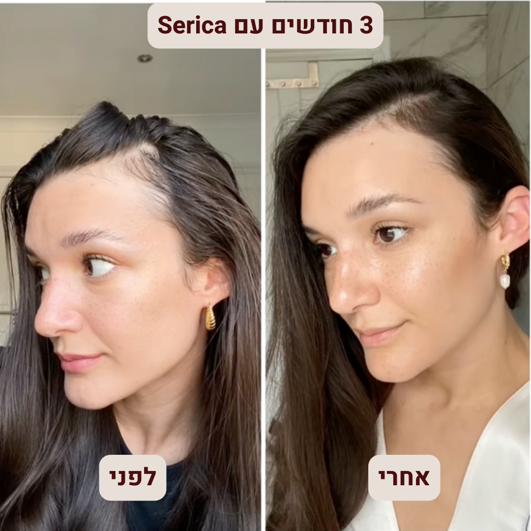 Serica – ערכת טיפוח טבעי לנשירה ושיער חלש | שמפו עם ביוטין וקונדישינר מועשר ברוזמרין ובצל לצמיחה חזקה וברק בריא (ללא סולפטים)